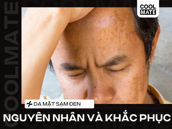 Da Mặt Sạm Đen Ở Nam Giới - Nguyên Nhân và Cách Khắc Phục