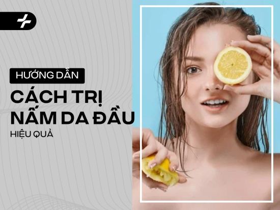 Hướng dẫn cách trị nấm da đầu bằng chanh hiệu quả nhất 2025