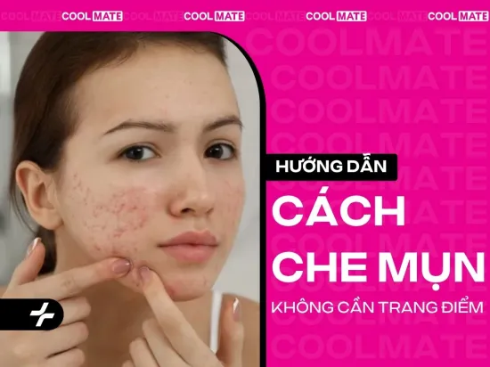 Cách Che Mụn Không Cần Trang Điểm: Mẹo Nhanh Gọn & Hiệu Quả