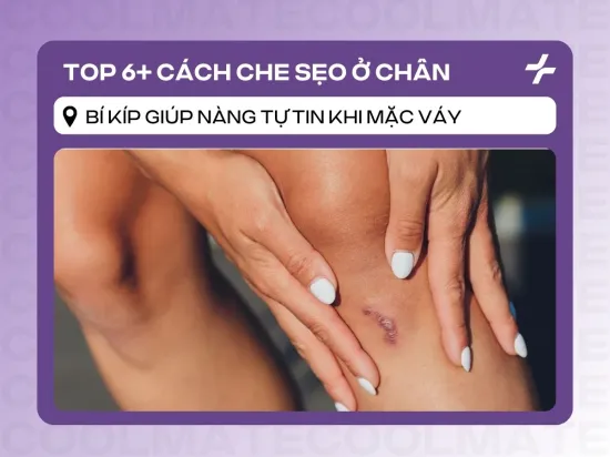 6 Cách Che Sẹo Chân Khi Mặc Váy: Bí Kíp Tự Tin Toả Sáng