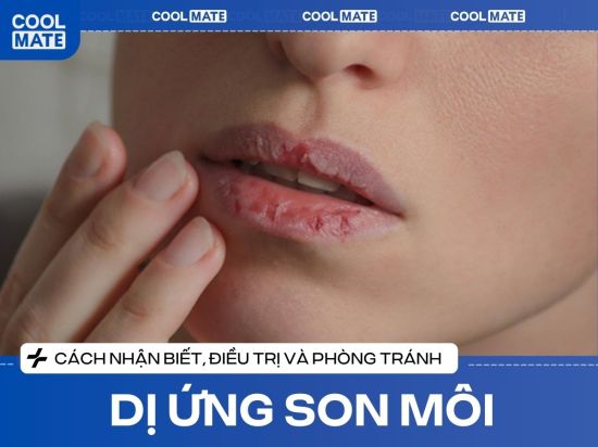 Dị Ứng Son Môi? Cách Nhận Biết, Trị & Phòng Tránh Cực Dễ!